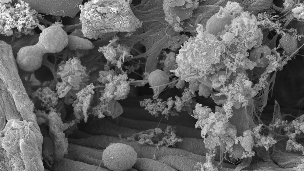 Gallery - compost tea thumbnail image